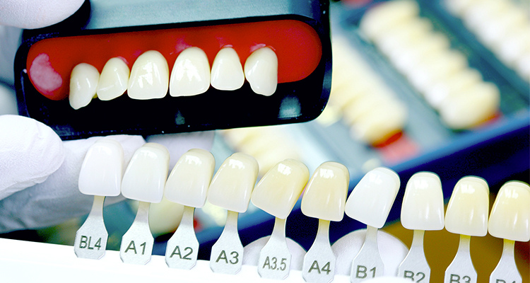 Акция на Эстетическое восстановление формы и цвета зуба в стоматологии композитными винирами
